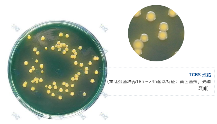 TCBS 瓊脂（霍亂弧菌培養(yǎng)18h～24h菌落特征：黃色菌落，光滑濕潤）