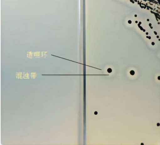 Baird-Parker瓊脂